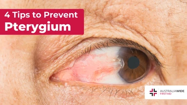 Prevent pterygium article header – First Aid Article in Mittagong